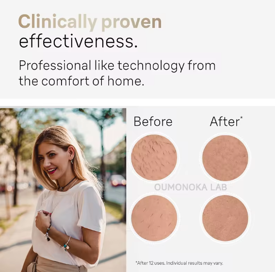 IPL LASER HAIR REMOVAL DEVICE