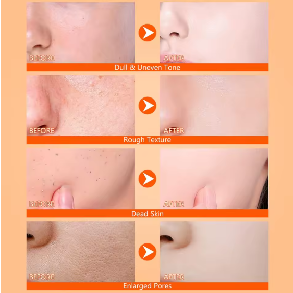 BODY KERATIN, KOJIC ACID & TURMERIC PEELING SPRAY